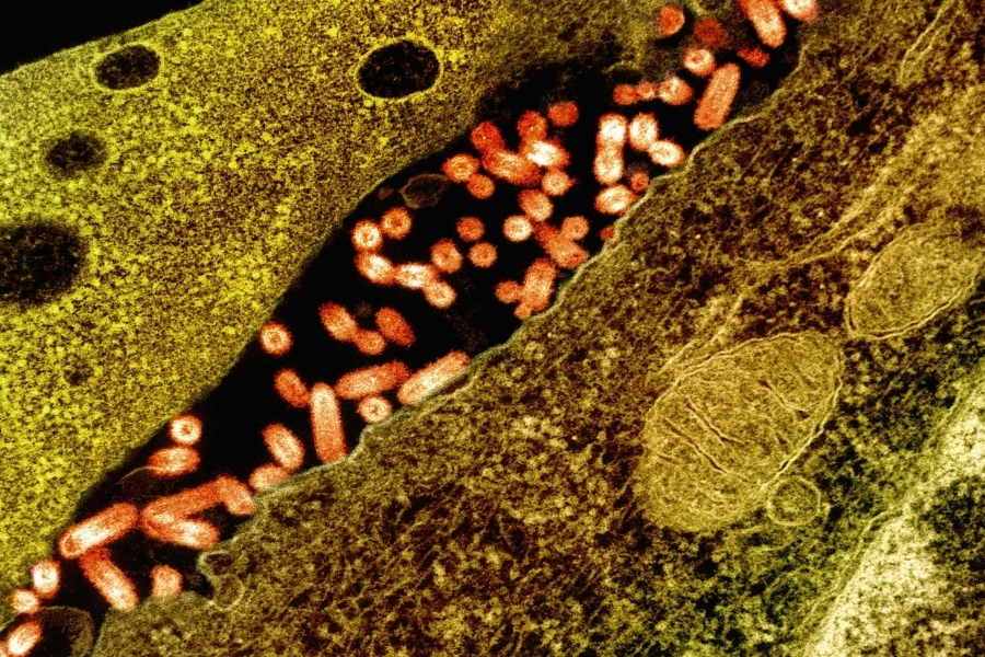 Candida Auris’in Topraktan İnsana Yolculuğu